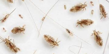 Safe Herbal Head Lice Treatment that works